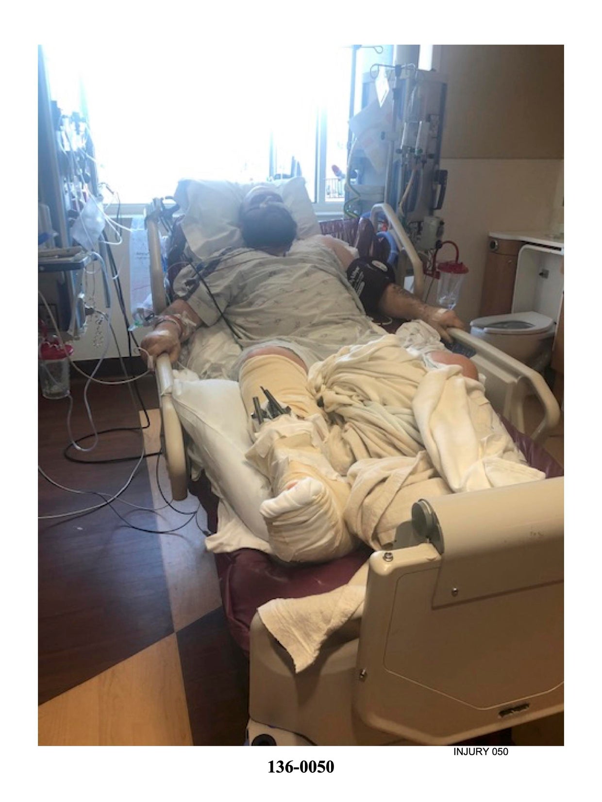 Man who lost leg in fracking explosion loses $14 million from jury ...
