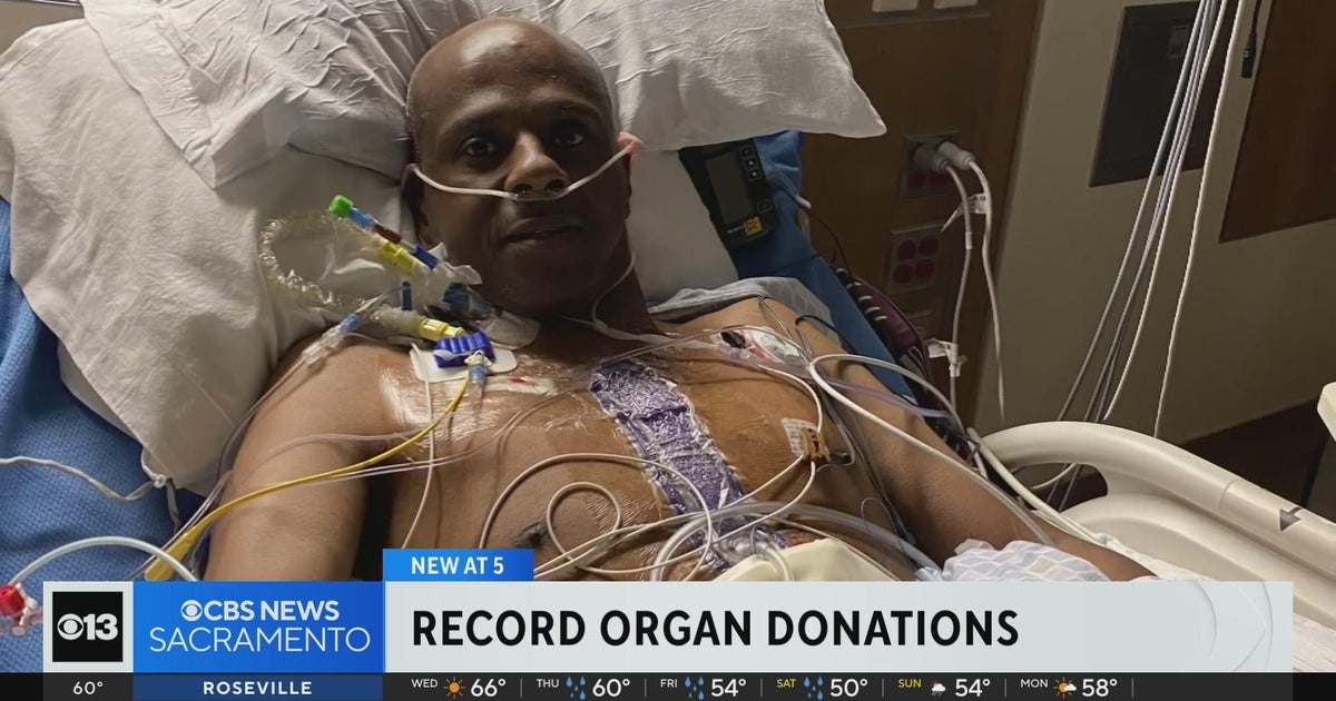 California organ donor service reaches record transplants in 2023