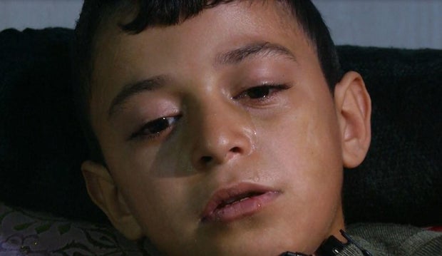Mohammad Hamad, 9, cries in a hospital bed in Deir al-Balah, northern Gaza, Feb. 28, 2024, after being the only member of his immediate family to survive an Israeli strike that hit their home several miles further north in Neseirat