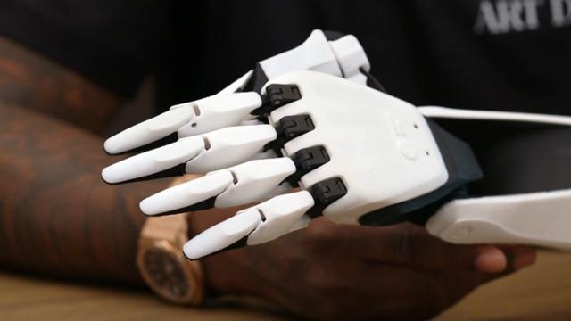 AI-powered prosthetic arm aims to be an accessibility game-changer - CBS  News