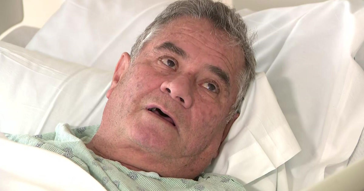 Victim of Everglades Countrywide Park crocodile assault speaks out