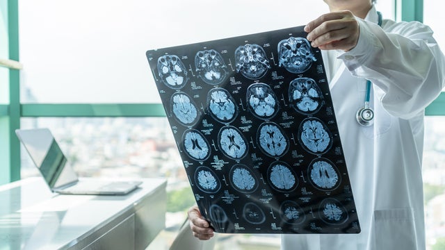 Brain disease diagnosis - doctor looks at Magnetic Resonance Imaging (MRI) diagnosing patient 