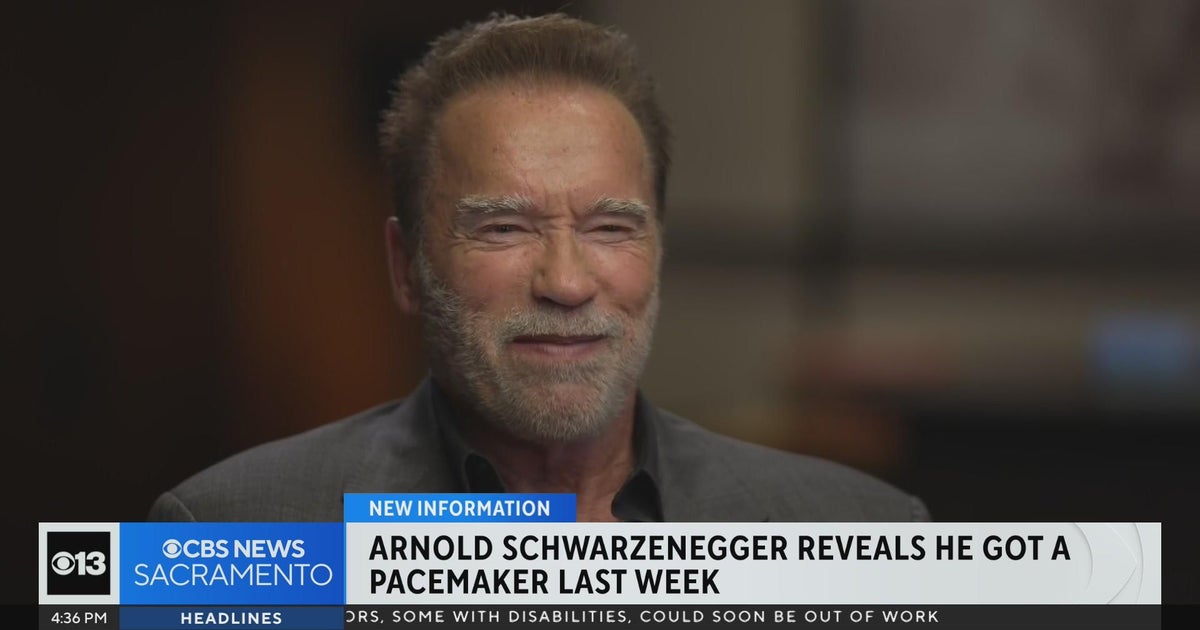 Arnold Schwarzenegger reveals he got a pacemaker last week