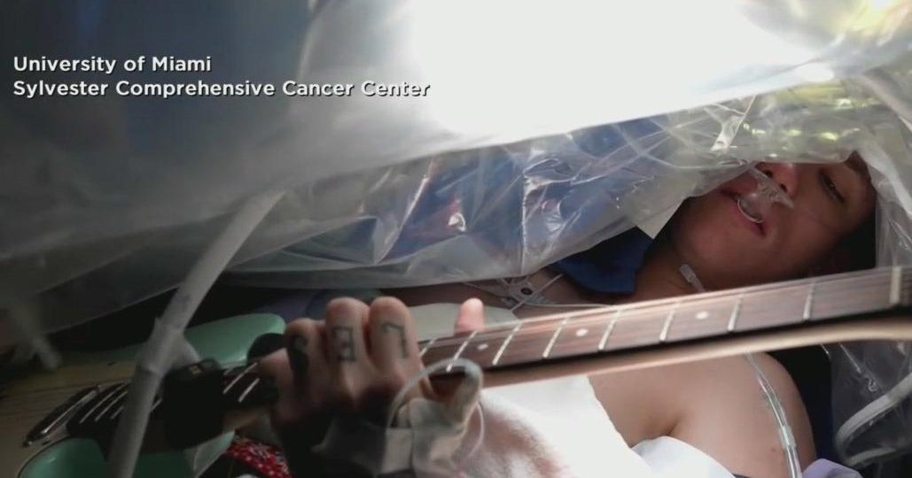 Miami man strummed guitar while doctors performed brain surgery on him - CBS Miami