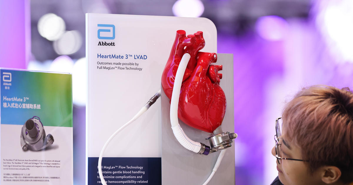 FDA обявява изземване на сърдечни помпи, свързани със смъртни случаи и наранявания