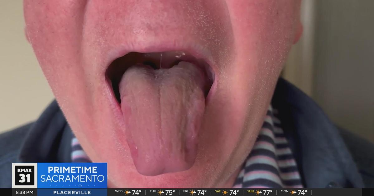 The Answer: Your tongue a sign of your health?