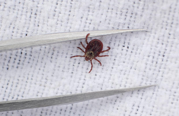 A tick and a pair of tweezers 