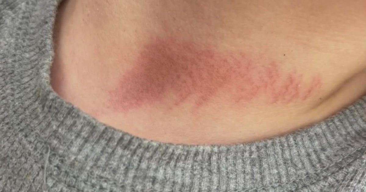 Child choked with jump rope at Fairfield after-school program, mother says