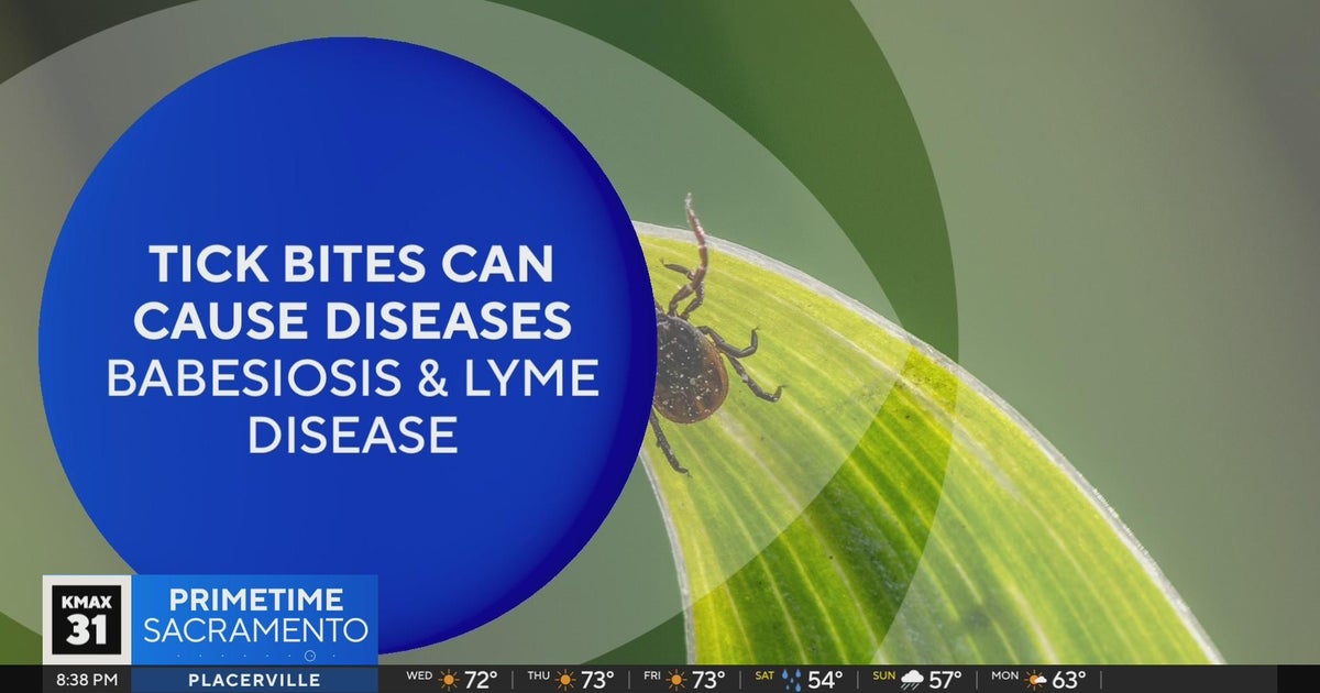 The Answer: Tick season safety?
