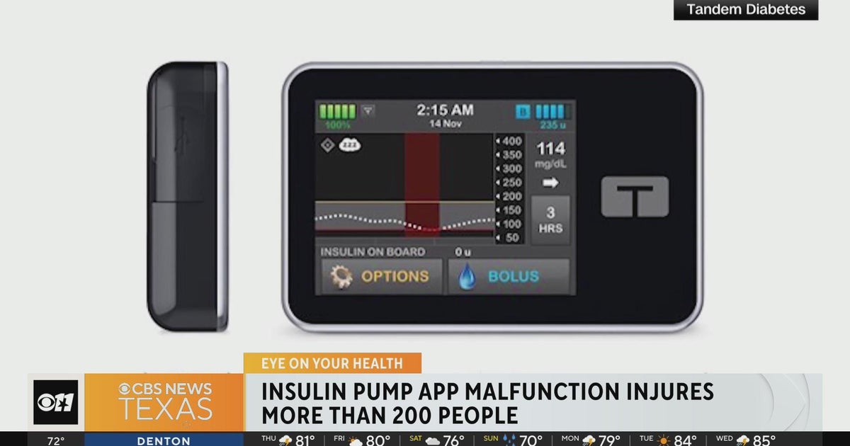 Insulin pump app malfunction injures more than 200 people CBS Texas