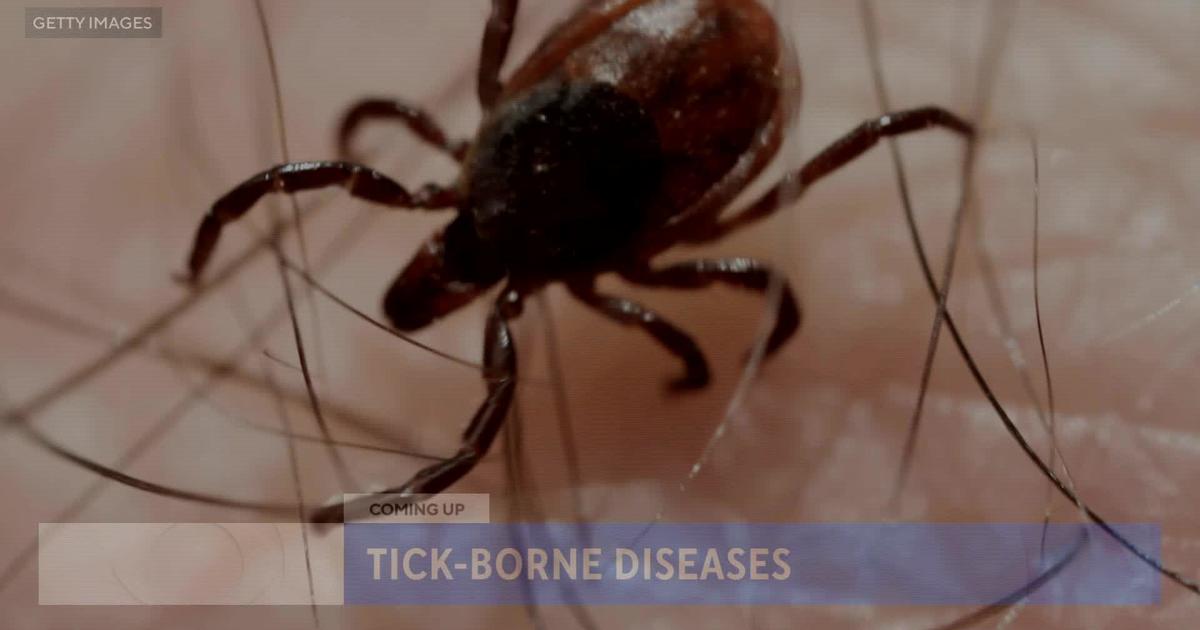 What you need to know about tick-borne disease (part 1) - CBS Minnesota