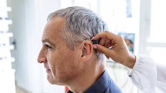 Doctor examining patient's hearing aid. 