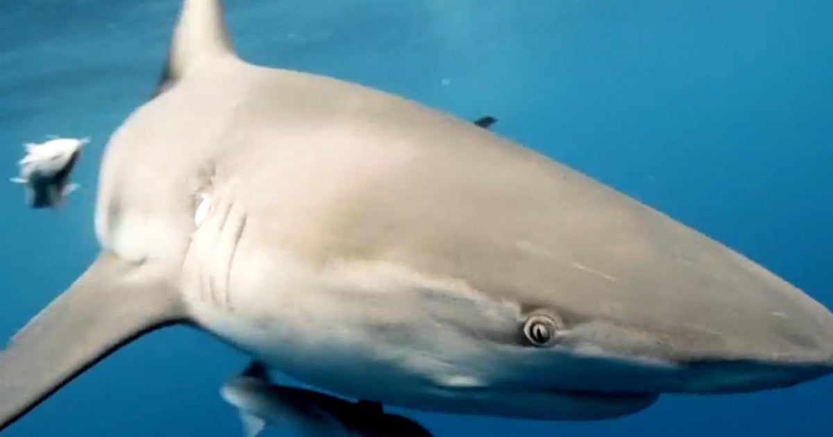 Spearfisherman talks about his shark encounter from his hospital bed Spearfisherman talks about his shark encounter from his hospital bed