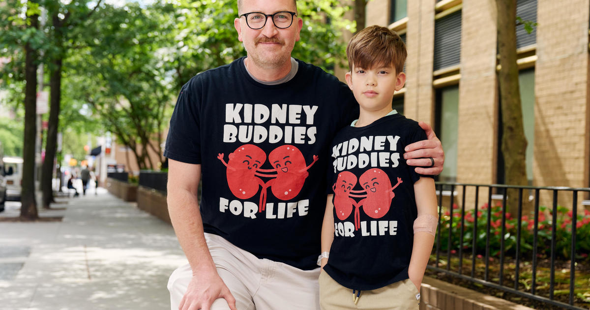 After son was born with a rare condition, father donates a kidney
