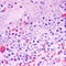 Plague kills Arizona resident, health officials say