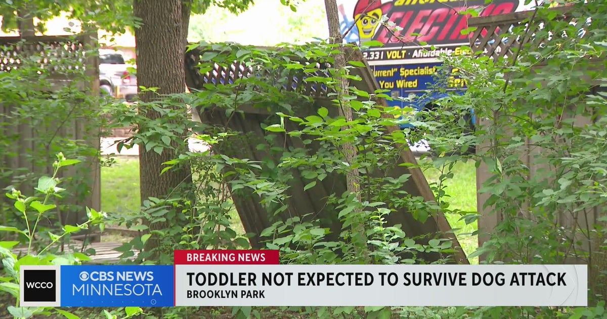Toddler attacked by dogs in Brooklyn Park not expected to survive CBS
