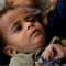 Israeli leaders agree to rare pause in fighting in Gaza amid polio crisis