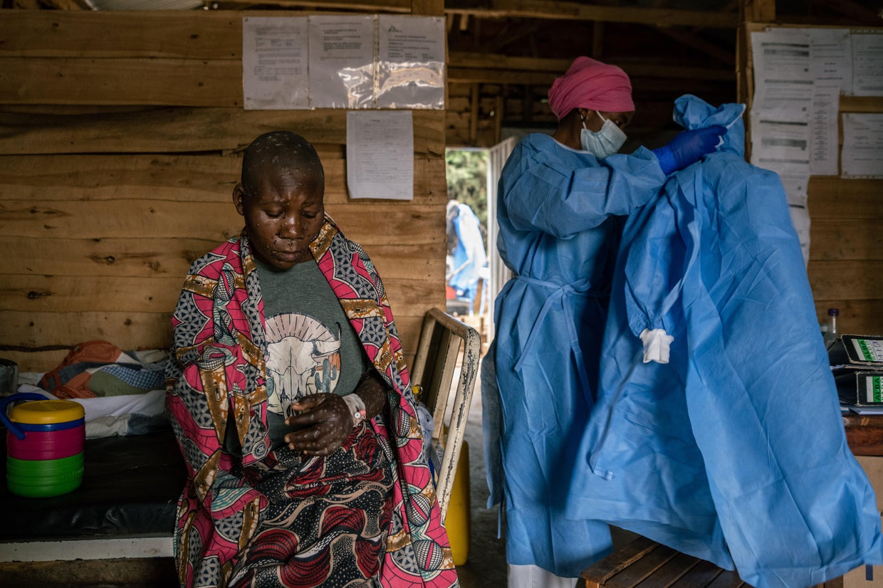 Congo gets first desperately needed mpox vaccines, but vaccination ...