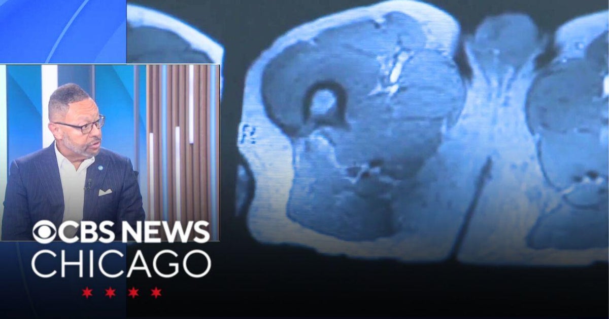 Cook Co. Commissioner shares cancer survival story, encouraging men to ...