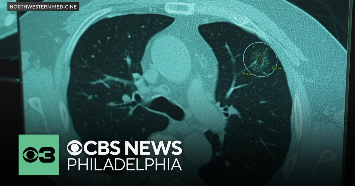 New discovery about long COVID might lead to better treatment, study ...