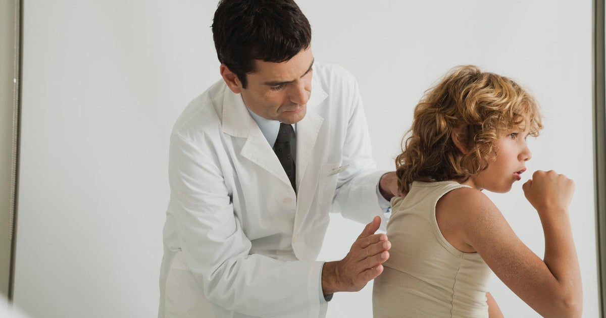 Whooping cough and walking pneumonia cases are up Heres what to know and how to help keep your family safe  CBS News Whooping cough and walking pneumonia cases are up Heres what to know and how to help keep your family safe  CBS News