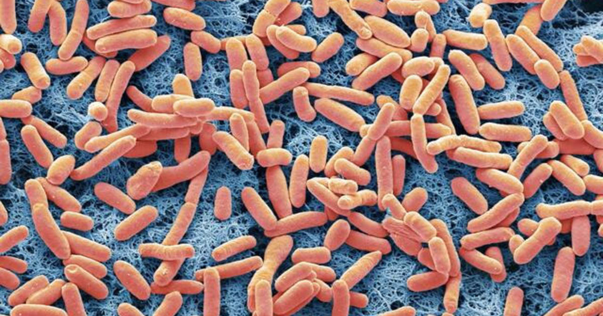 Deadly E.coli outbreak linked to McDonald