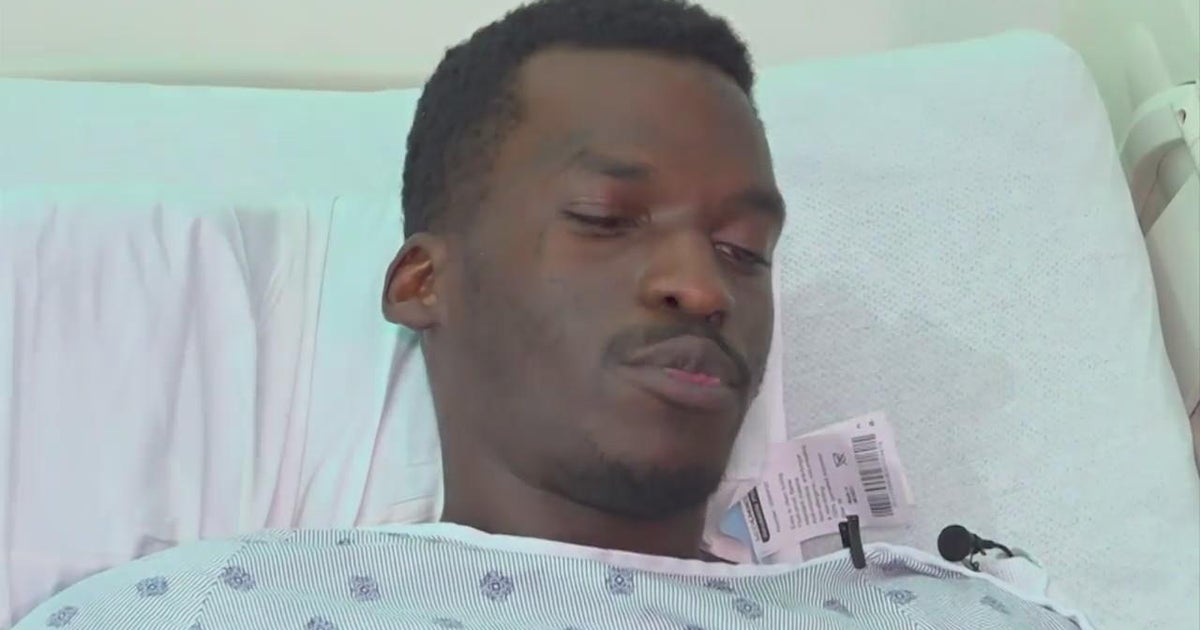 Man shot in front of Wynwood burger joint shares his story - CBS Miami