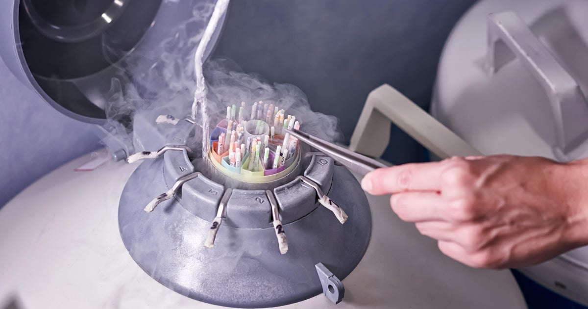 Serial sperm donors and lack of regulation create risks and leave children seeking answers Serial sperm donors and lack of regulation create risks and leave children seeking answers