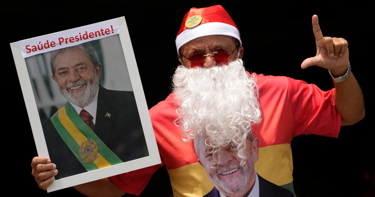 Brezilya Devlet Başkanı Lula, beyin kanamasını durdurmak için geçirdiği ameliyatın ardından hastaneden taburcu edildi