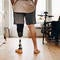 Insurers limit coverage of prosthetic limbs, questioning medical need