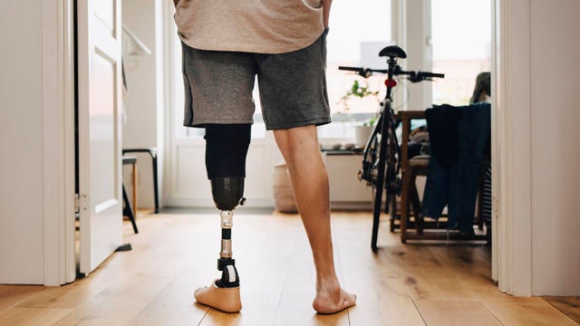 Low section rear view of man with prosthetic leg standing at home 