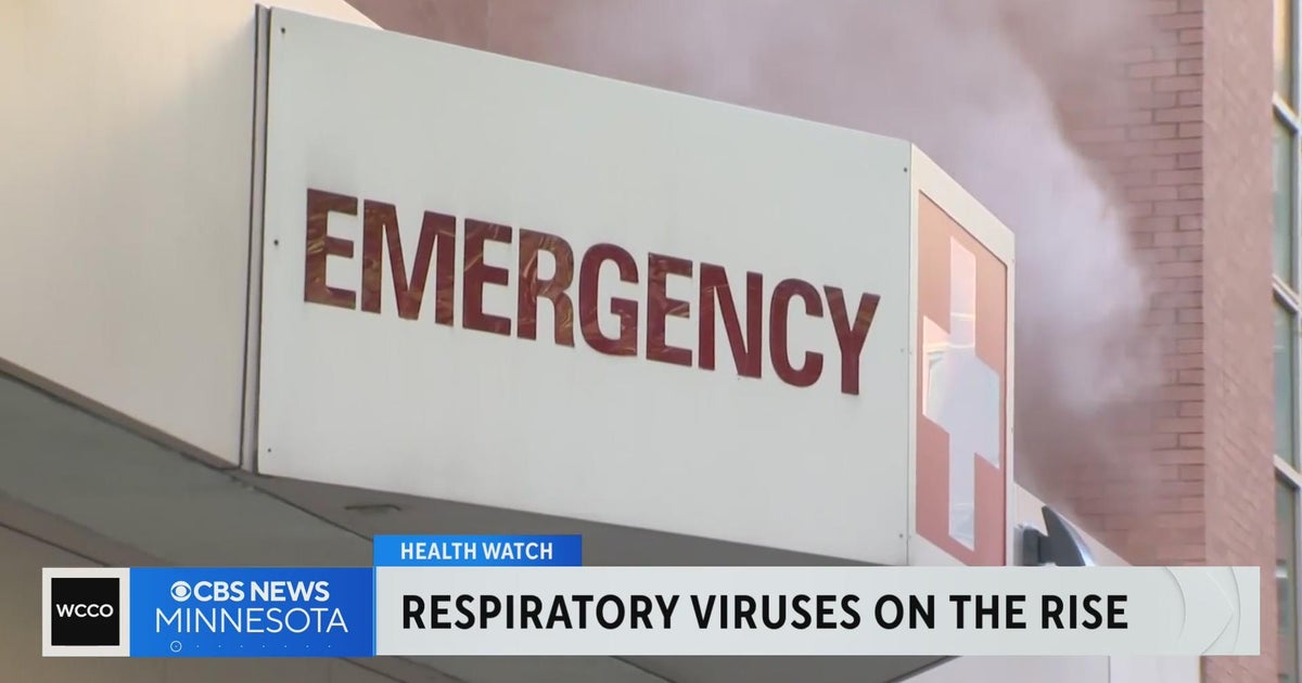 Winter viruses sending more people to emergency rooms - CBS Minnesota