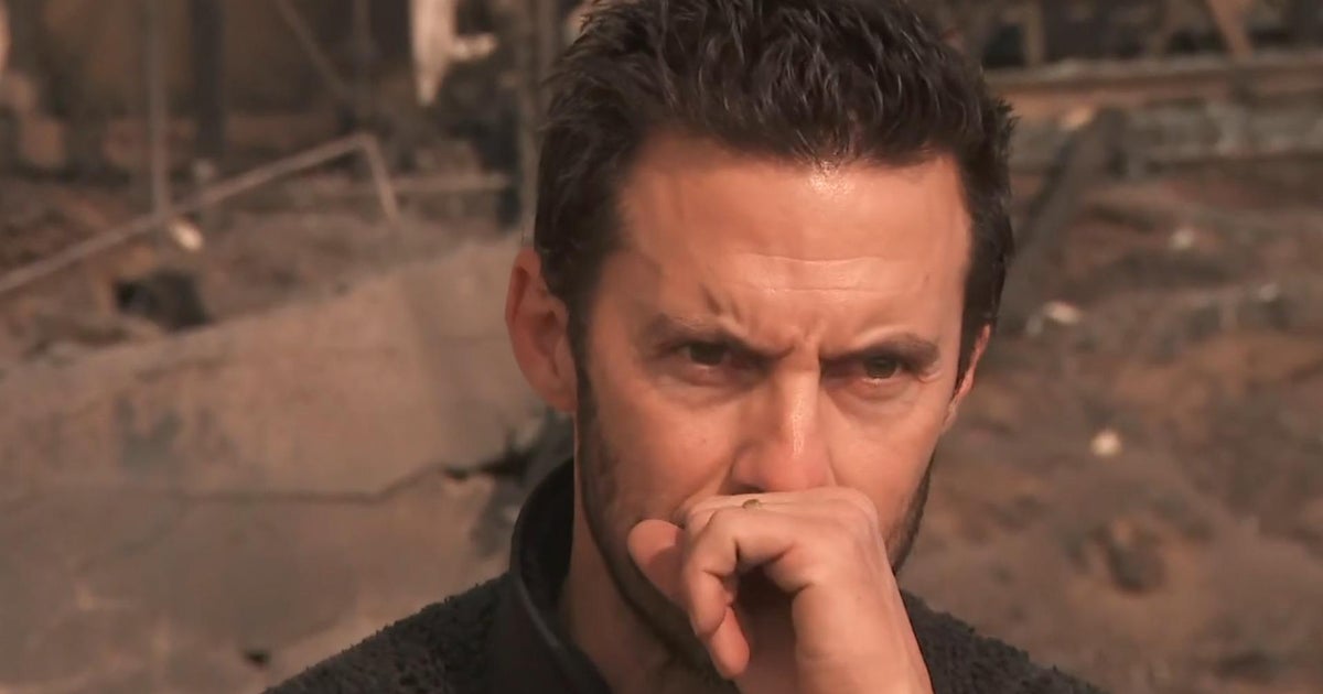 Milo Ventimiglia Loses Malibu Home in Wildfires