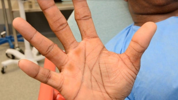 Renard Spivey evidence