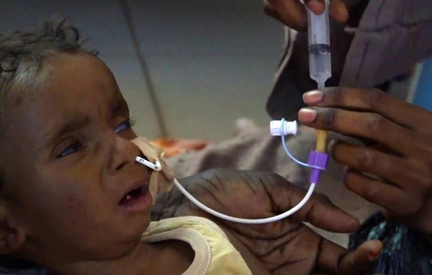 sudan-starvation-cbs-2025.jpg