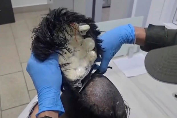 Colombia cocaine hair
