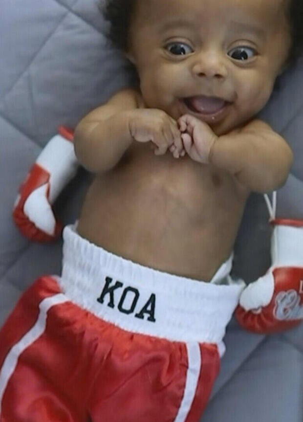 Koa wearing a boxing outfit that says his name 