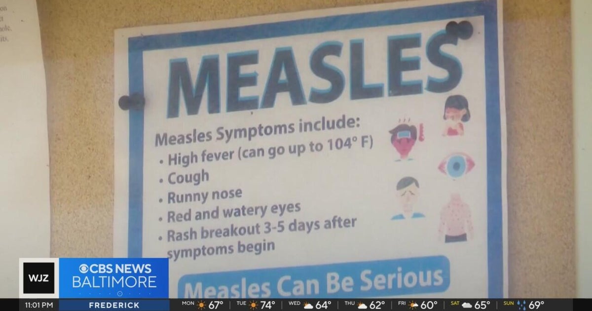 Maryland resident has case of measles, health department confirms Maryland resident has case of measles, health department confirms