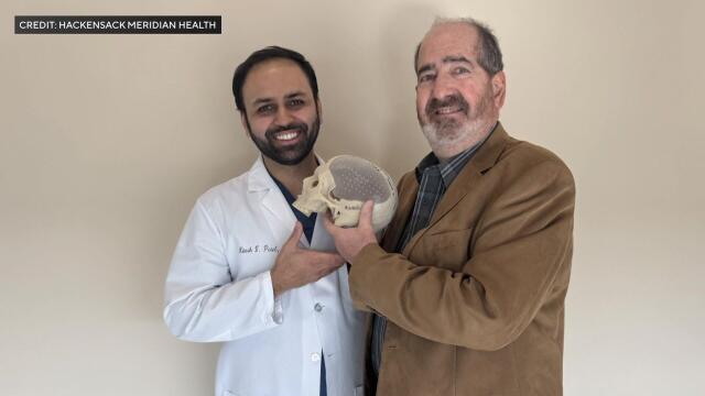 Dr. Nitesh Patel and patient Greg Morrison pose with a 3D-printed replica of Morrison's skull. 