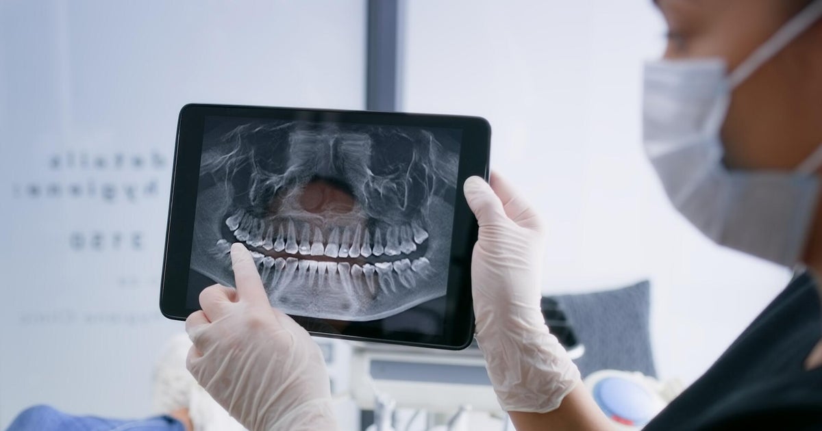 How taking care of your teeth could protect your heart and brain health How taking care of your teeth could protect your heart and brain health