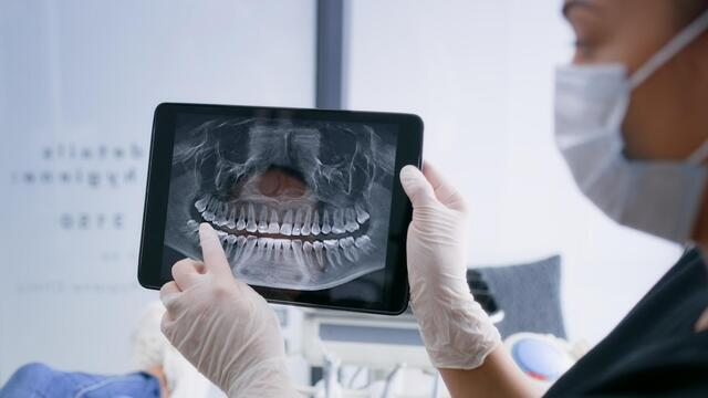 Hands, tablet and teeth xray, dentist and patient with dental surgery and health, people and orthodontics at clinic. Healthcare, wellness and digital scan of mouth on screen with cavity or gingivitis 