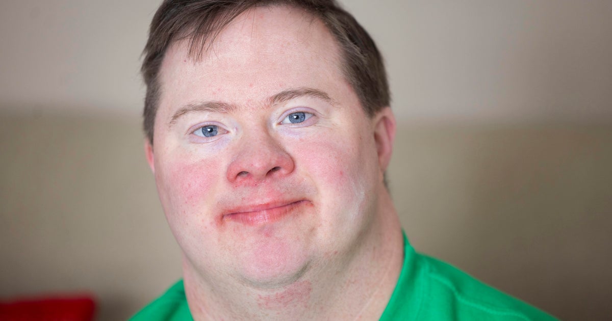 ABLE accounts allow Americans with disabilities to save and invest. Here’s how. ABLE accounts allow Americans with disabilities to save and invest. Here’s how.