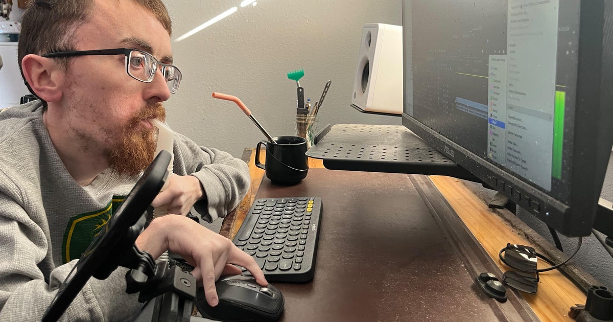 Many people with disabilities risk losing their Medicaid if they work too much Many people with disabilities risk losing their Medicaid if they work too much