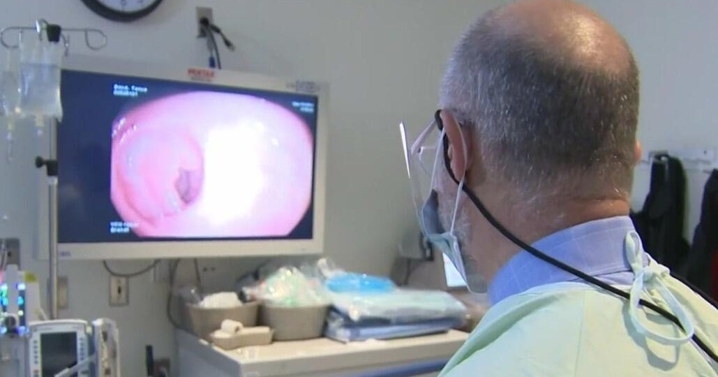 Colon cancer in young adults is on the rise, doctor says