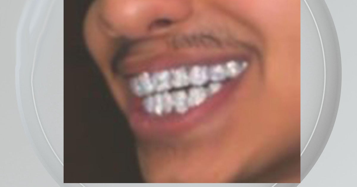 Florida man sentenced to 6 years for  million COVID relief fraud, splurging on diamond grills Florida man sentenced to 6 years for  million COVID relief fraud, splurging on diamond grills