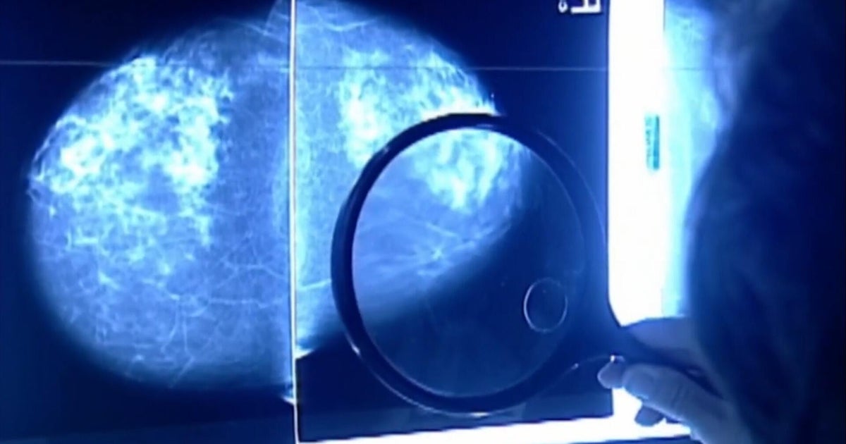 What to know about rising cancer rates