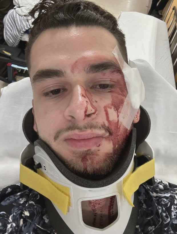 pics-of-suffolk-victim.jpg 