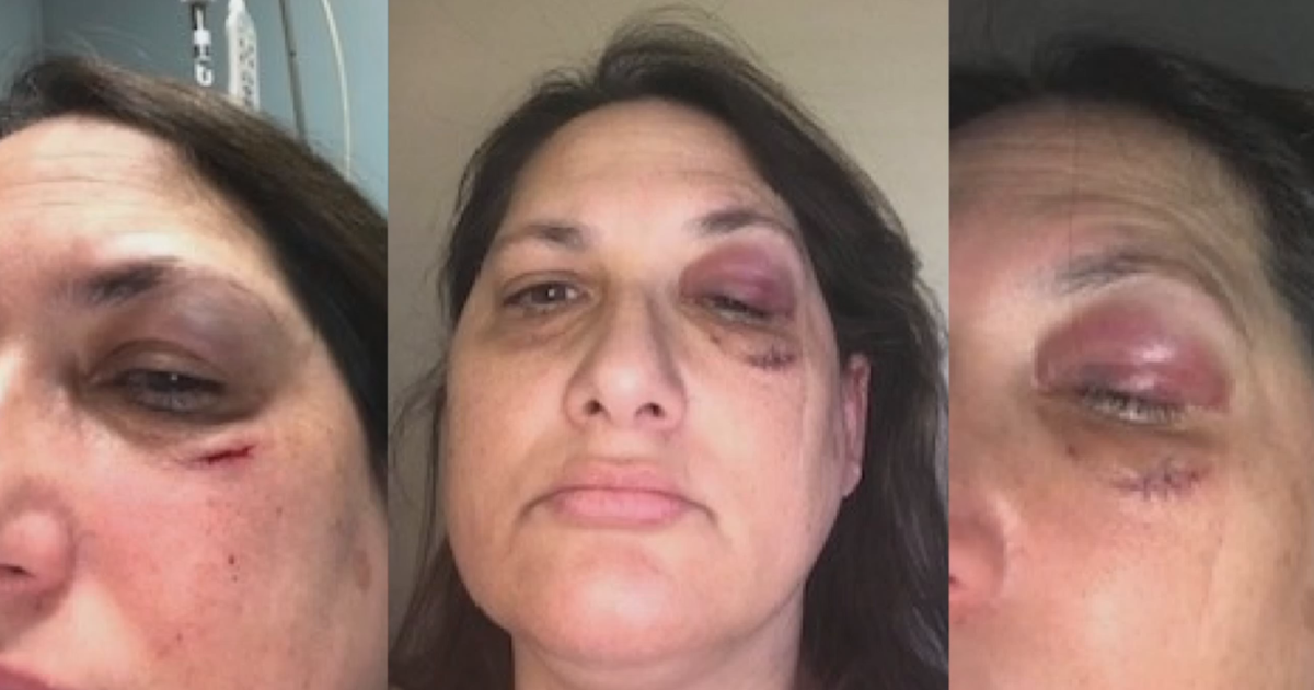 Nurse reveals brutal attack in the ER as Maryland healthcare workers increasingly face violence on the job Nurse reveals brutal attack in the ER as Maryland healthcare workers increasingly face violence on the job