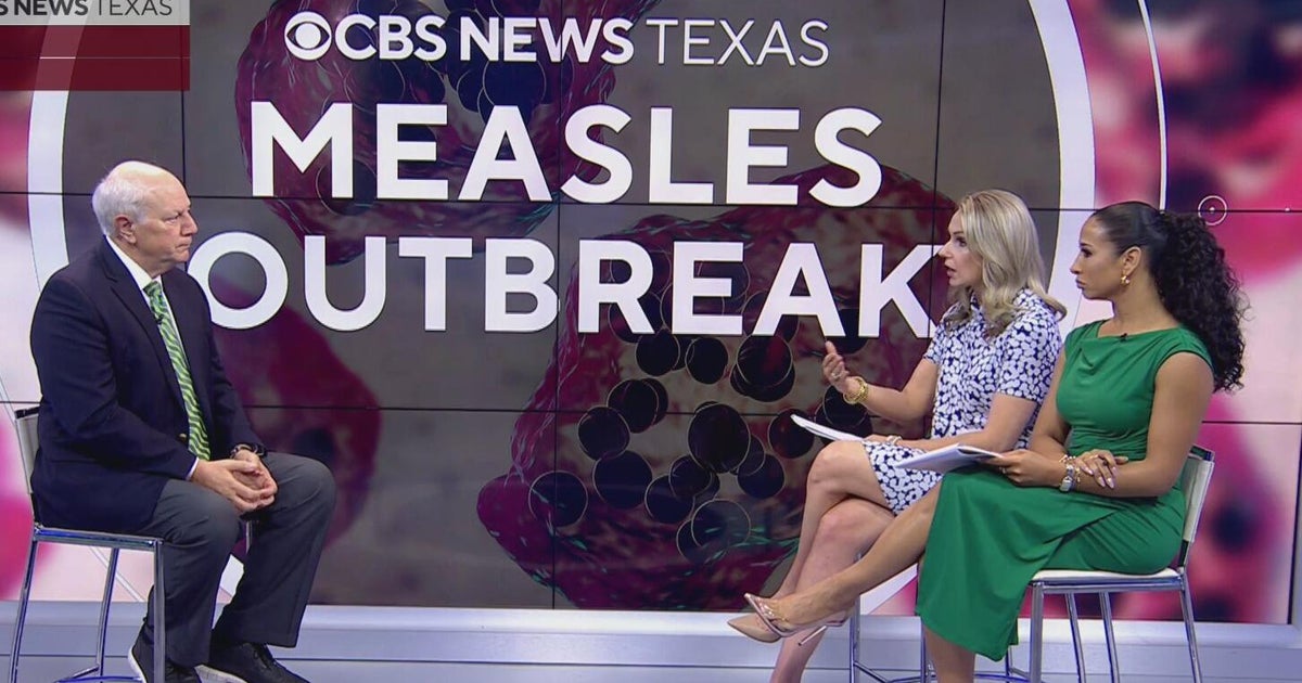 What you need to know about the measles as more cases confirmed in ...
