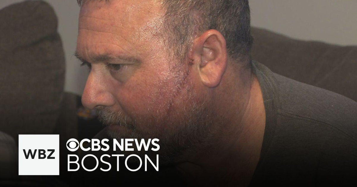 Malden father slashed outside Boston hospital - CBS Boston